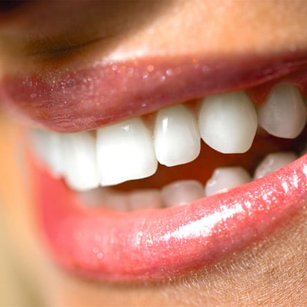 A close up image of a smile with white teeth