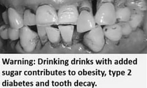 Health warning with rotten teeth image for sugary drink study