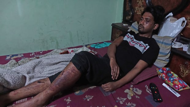 Rafiq lying in bed at home in the Kardampuri locality of Delhi. The young Muslim tailor was beaten by some policemen when they turned violent against protesters in the last week of February.