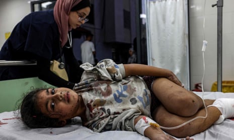 An injured Palestinian girl at the Kuwaiti hospital in Rafah in the southern Gaza Strip.