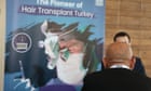 Britons seeking medical treatments overseas ‘should beware low prices’