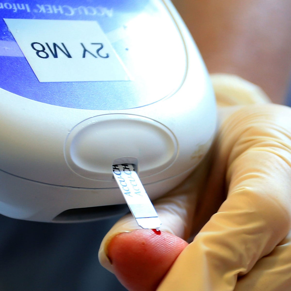 Covid 19 People With Type 1 Diabetes More Likely To Die Than Those With Type 2 Study Diabetes The Guardian Covid 19 People With Type 1 Diabetes More Likely To Die Than Those With Type 2 Study Diabetes The Guardian