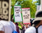 Restrições ao aborto nos EUA dificultam tratamento de aborto espontâneo