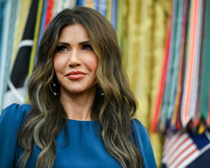 Why does the Maga elite love conspicuous cosmetic surgery? | Arwa Mahdawi