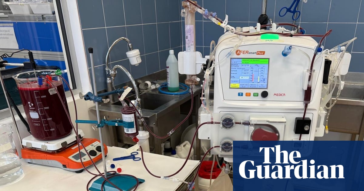 NHS to trial potentially life-saving treatment for deadly liver disease