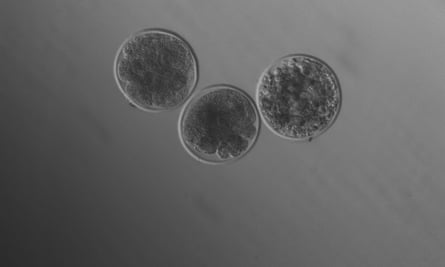 Kangaroo ICSI embryos