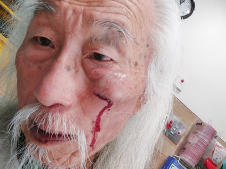 Danny Lim photographed with facial injuries