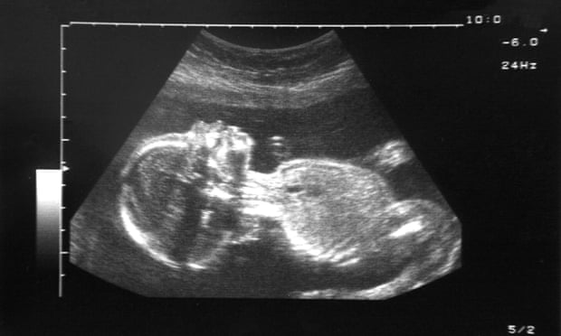Baby in the womb