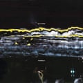 The artwork for Pugnello depicting jagged long white and yellow lines across a black background