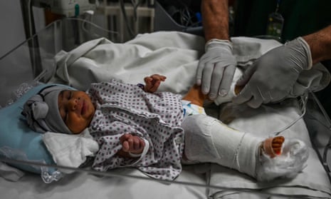 A newborn baby, Bibi Amena, is treated for a gunshot wound to her leg after being rescued from the maternity hospital attack that killed her mother. 