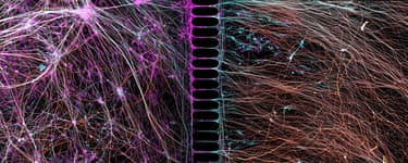 Human neurons reprogrammed from skin cells growing in a microfluidic chamberConfocal