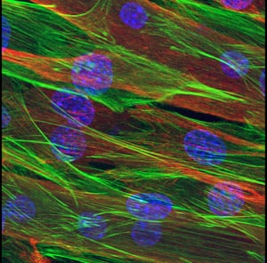 Myotube grown in a dish using muscle stem cells.