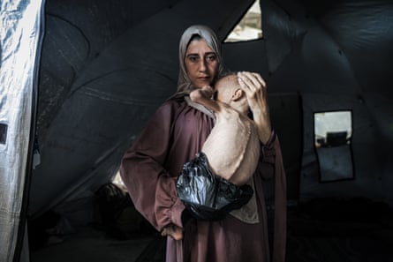 A young, malnourished child is held by his mother in Gaza City