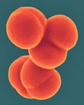Group A streptococcus bacteria