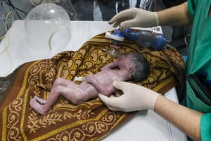 A newborn baby lies on piece of cloth as medics at the emergency unit of the Kuwait hospital in Rafah, Gaza, try to treat the child