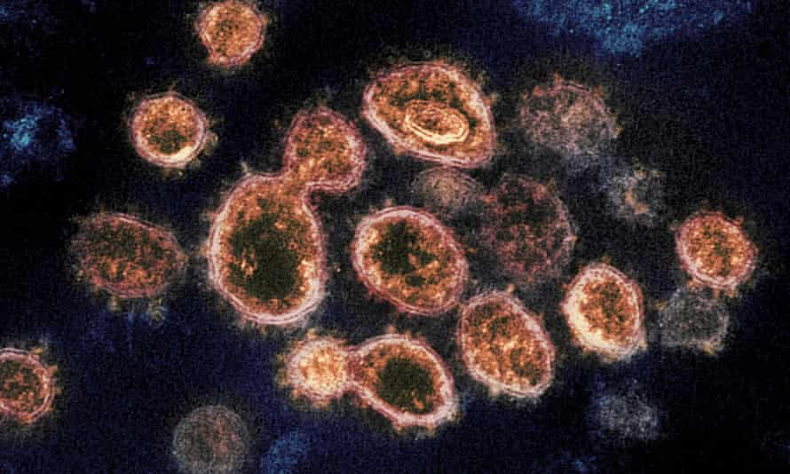 Sars-CoV-2 virus particles which cause Covid-19, as seen under a microscope. In April, the World Health Organization formally acknowledged that Covid is predominantly spread via the air.