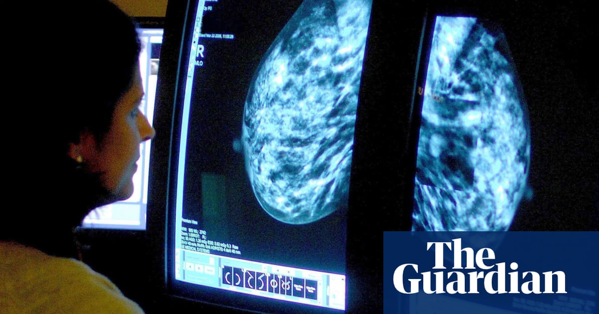 Breast cancer drug approved for NHS after maker agrees discount