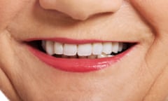 Close up on old woman’s perfect smile, teeth.