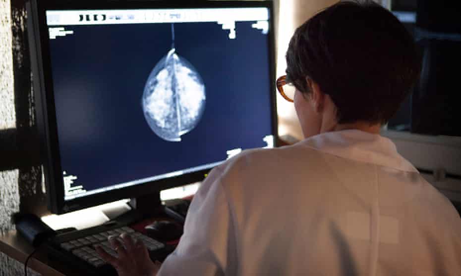 A radiologist examines mammograms. The leading manufacturer of textured implants has withdrawn them from worldwide sale.