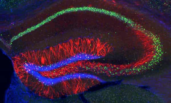 amnesia researchers use light to restore lost memories in mice medical research the guardian