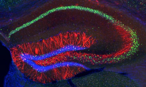MIT neuroscientists identified the cells (highlighted in red) where memory traces are stored in the mouse hippocampus.