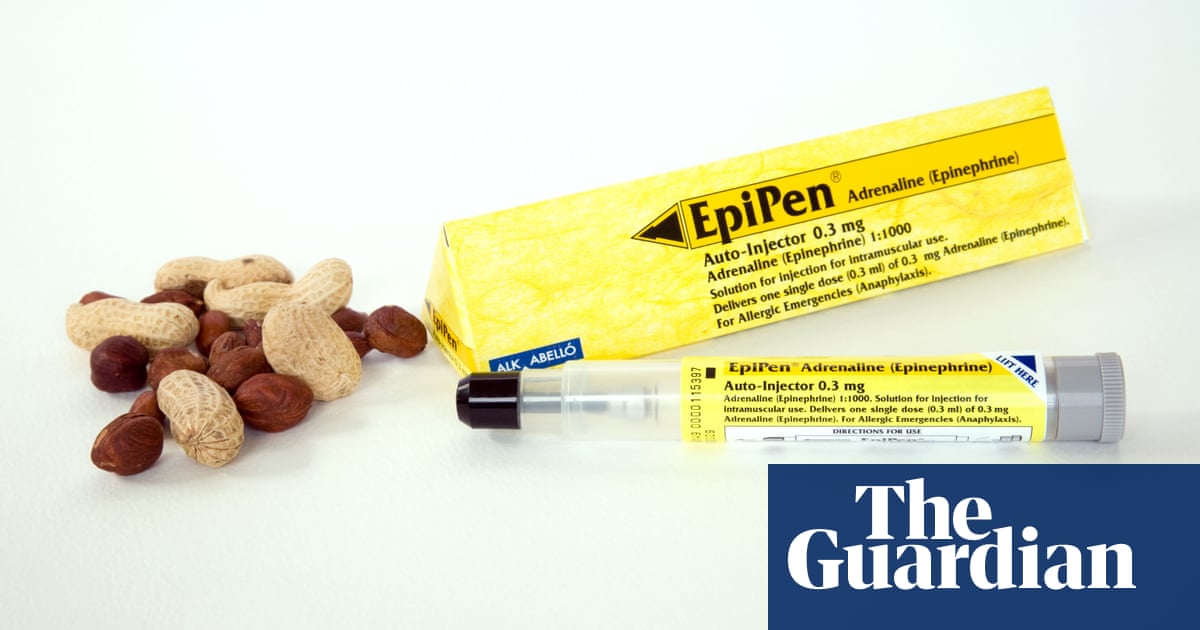 Daily peanut exposure can desensitise allergic adults, study suggests