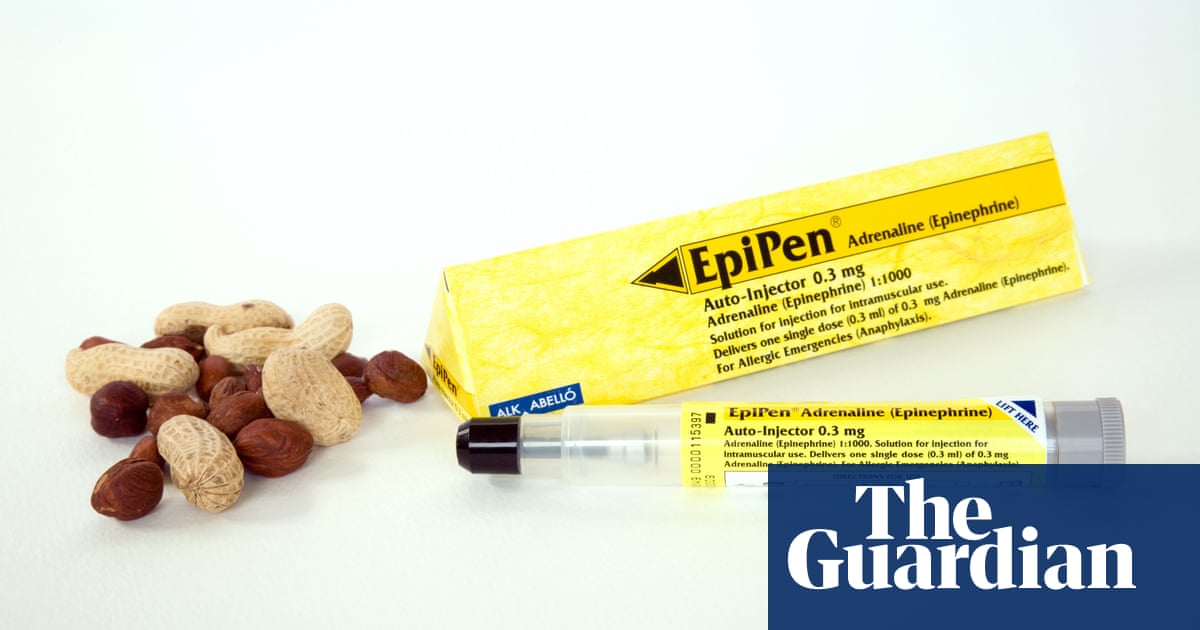 Daily peanut exposure can desensitise allergic adults, study suggests