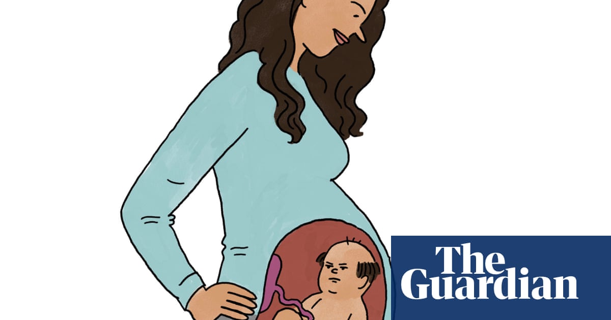Is it true that  male pattern baldness is inherited from the mother?