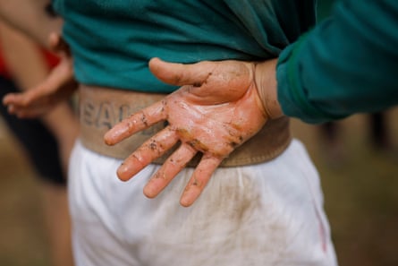 The hand of a competitor from the Basque Country, covered in sticky resin to help him grip the rope.