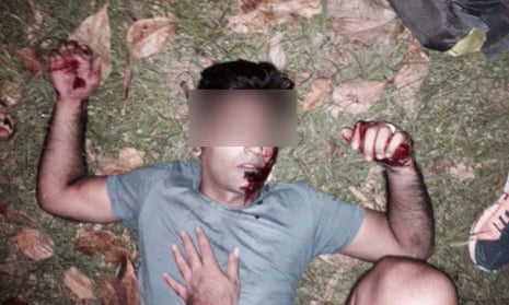 A refugee who was knocked unconscious with a rock while riding his bike in Nauru.