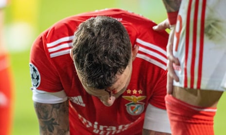 Blood drips off the head of Benfica defender Nicolás Otamendi (30) after a clash with Liverpool midfielder Fabinho.