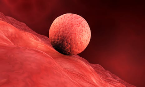 A biomedical illustration of embryo implantation