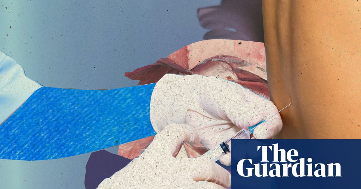 I got an epidural for all three of my births none of them worked as expected