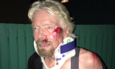 An injured Richard Branson after his accident