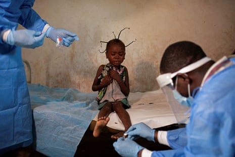 Theopiste Maloko, 42, a local health official, and a nurse collect skin samples from Angelika Lifafu, 6, to test for monkeypox, at the Yalolia health centre, in Tshopo, Democratic Republic of Congo on 3 October