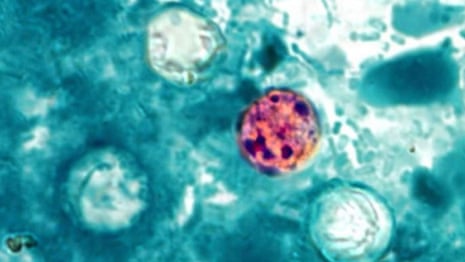 Cyclospora cayetanensis, the unicellular parasite that causes an intestinal infection called cyclosporiasis.