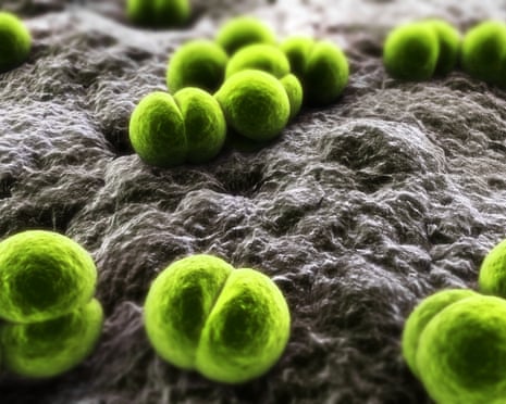 Funzionari sanitari che indagano sulla meningite epidemia