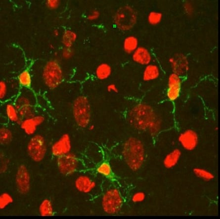 Microglial cells, outlined in green stain, have thin processes that reach out around brain cells, stained in red.