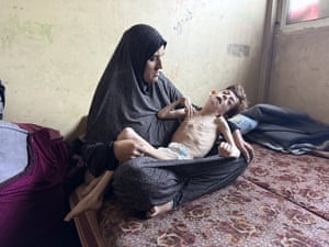 A woman cradles her emaciated son
