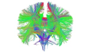 Brain white matter scan