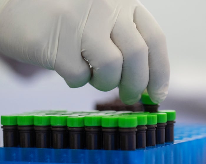 Mpox smuggling case prompts congressional scrutiny of National Institutes of Health
