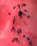 A section of a lung showing soot deposits, taken by Iboroma Aku Shed during an operation in Port Harcourt, Nigeria