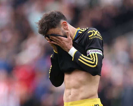 Bruno Fernandes hides his head in his hands after his penalty was saved