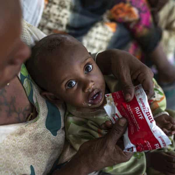 Letmedhin Eyasu holds her son Zewila Gebru, who is suffering from malnutrition, at a health centre in Agbe, Ethiopia.