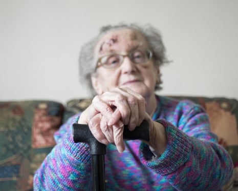 Woman sitting on a sofa with stick and head injury