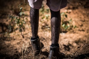 Legs of Wunggurr Ranger Dean Wungundin.