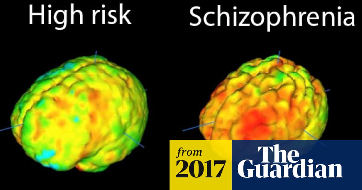 Radical New Approach To Schizophrenia Treatment Begins Trial Schizophrenia The Guardian Radical New Approach To Schizophrenia Treatment Begins Trial Schizophrenia The Guardian