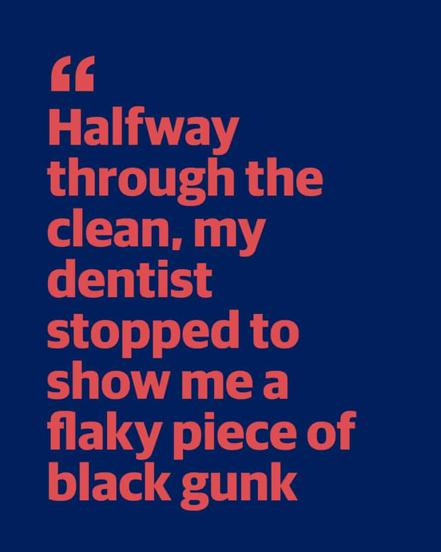 ‘My mouth was the Temple of Doom’: I survived my first dentist appointment in a decade 1 Quote: