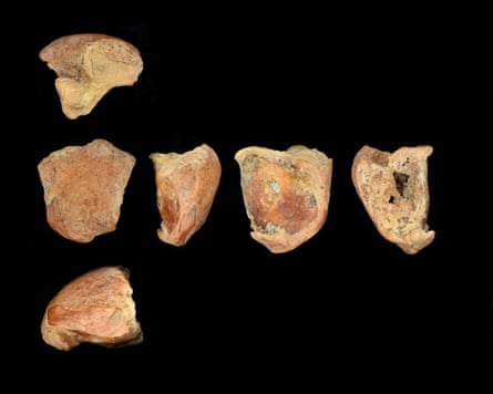Views of teeth from skeletal remains