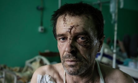 One of the patients in the hospital in Kostyantnivka